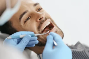 Tooth Extraction