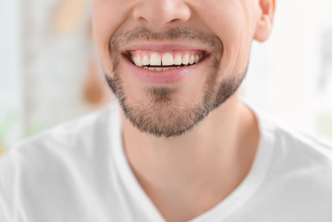 Denturly Tooth Whitening
