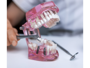 Dentures