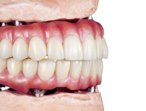 Dentures